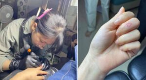 Không phân biệt được trái phải, cô gái xăm hình lên ngón tay để nhận biết