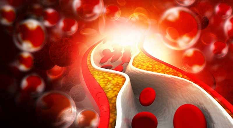 Rối loạn lipid máu: Hướng dẫn chẩn đoán và điều trị 12 Một số loại thuốc có thể làm tăng cholesterol