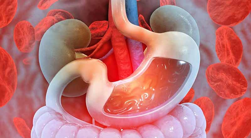 Người bệnh dạ dày nên ăn gì?