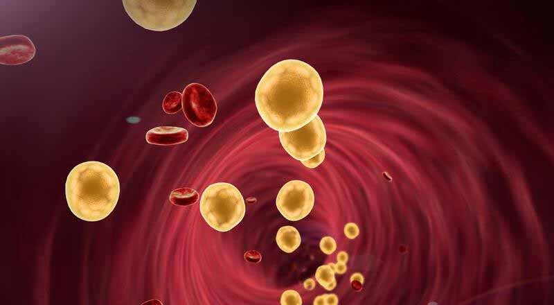 Rối loạn lipid máu: Hướng dẫn chẩn đoán và điều trị 11 Nguyên nhân gây mỡ máu cao