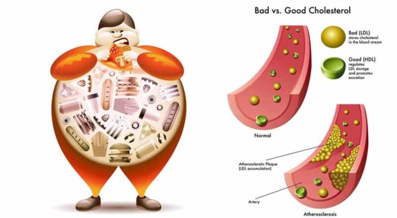 Rối loạn lipid máu: Hướng dẫn chẩn đoán và điều trị 15 Thói quen lành mạnh để kiểm soát mỡ máu